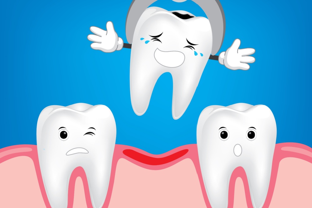 tooth extraction