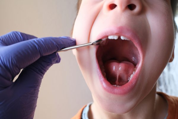 Pediatric Airway Dentistry