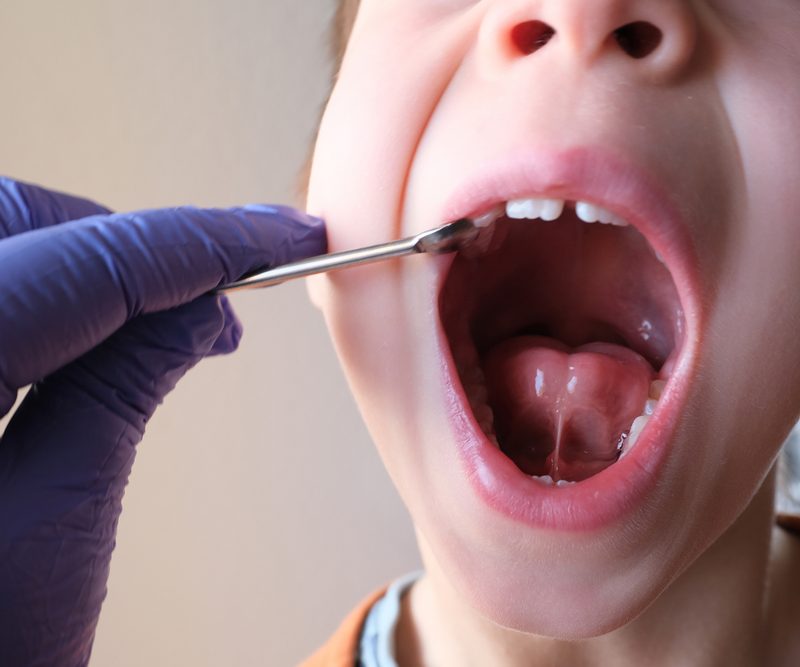 Pediatric Airway Dentistry