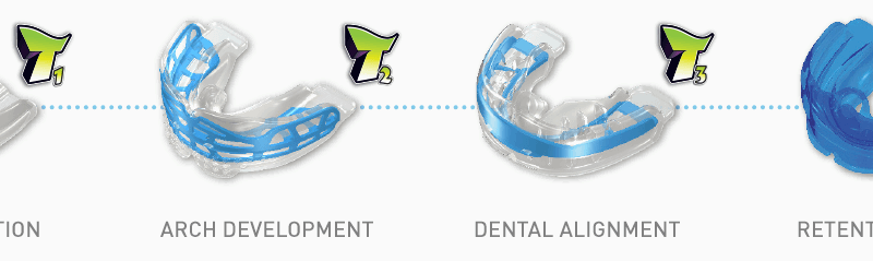 Mouth Guard for Child Near Me Kirkland WA