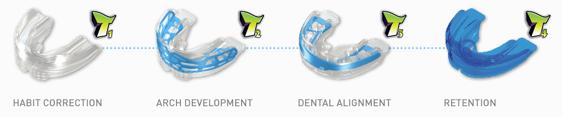 Mouth Guard for Child Near Me Kirkland WA